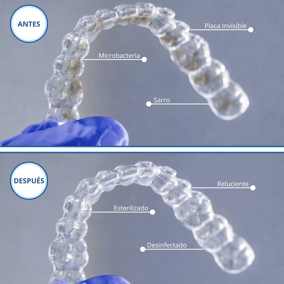 SonicSmile™ Limpiador Ultrasónico